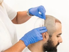 post procedure care 768x576.webp