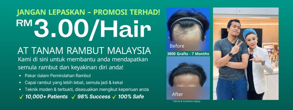tanam rambut banner website (2)